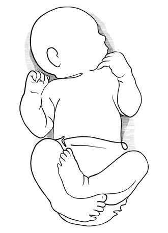 Noak
